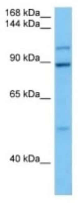 SMC6L1 Rabbit anti-Human, Polyclonal, Novus Biologicals 100 &mu;g | Buy Online | Novus Biologicals | Fisher Scientific